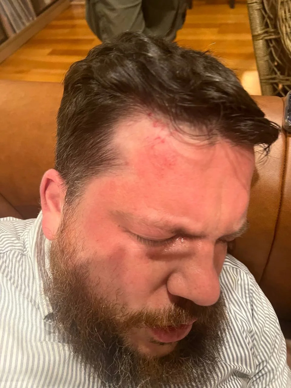 Volkov after the attack. Photo: Ivan Zhdanov